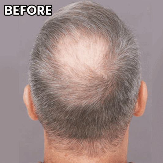 RegenHair - Hair Fibers